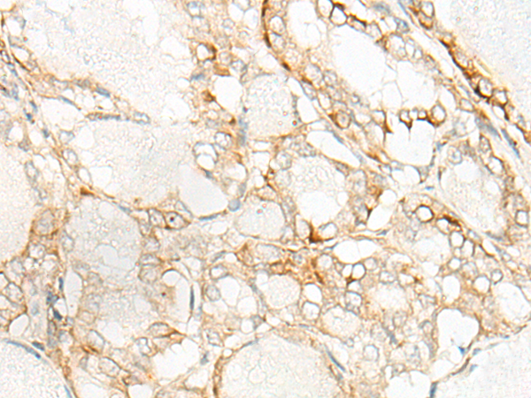 Rabbit Polyclonal Antibody to CNOT6