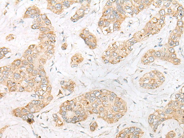 Rabbit Polyclonal Antibody to MICU3