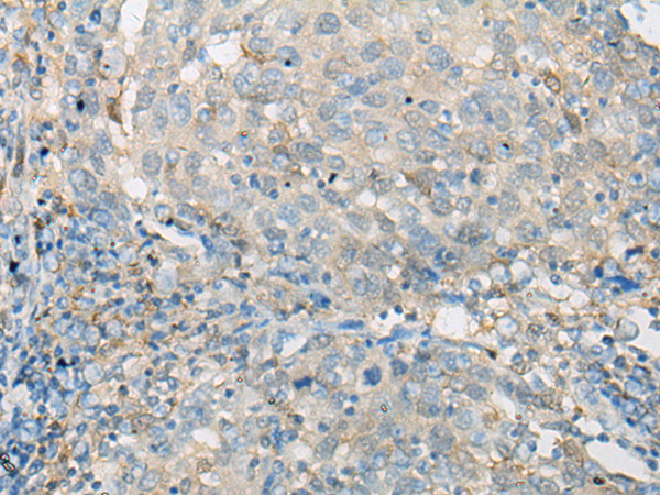 Rabbit Polyclonal Antibody to EFHD2