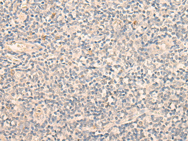 Rabbit Polyclonal Antibody to EHD3
