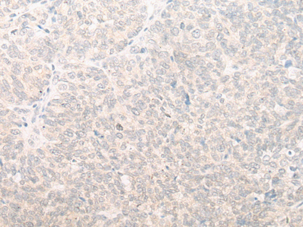 Rabbit Polyclonal Antibody to EIF2D