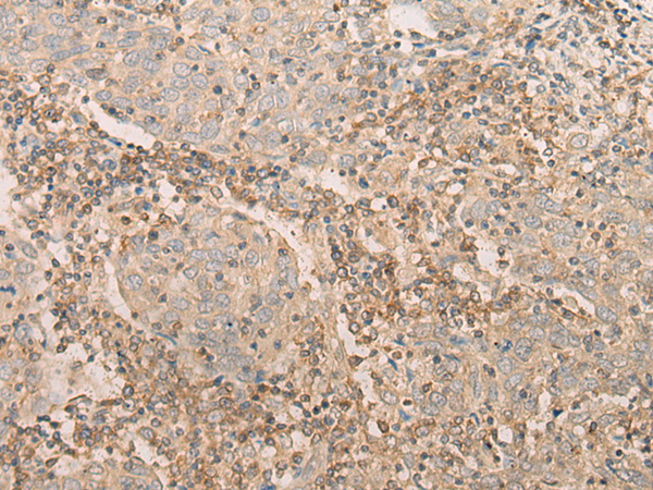 Rabbit Polyclonal Antibody to EIF2S1