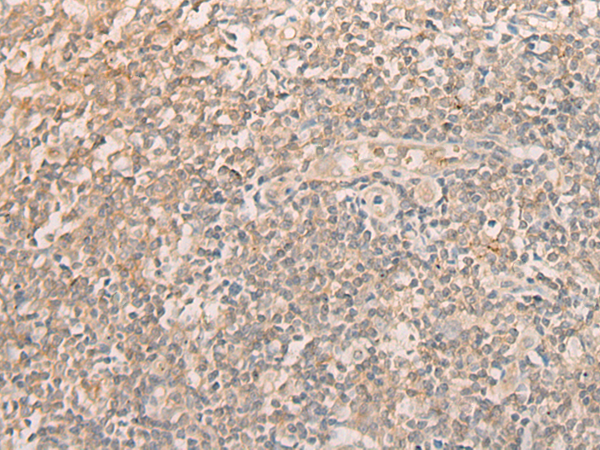 Rabbit Polyclonal Antibody to EIF2S1