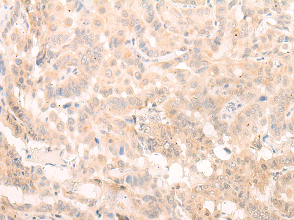 Rabbit Polyclonal Antibody to EIF3B