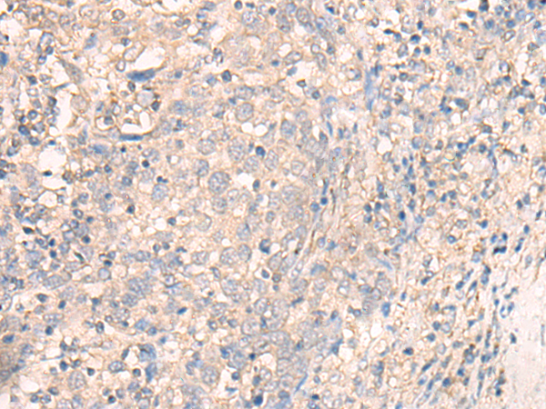 TMEM45A