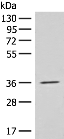 EPSTI1