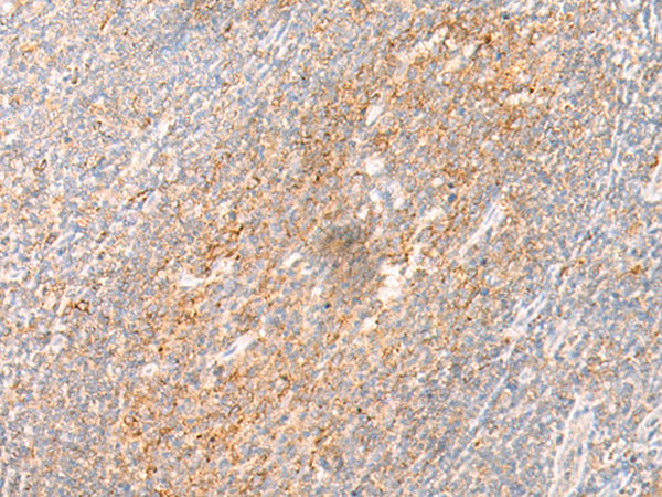 Rabbit Polyclonal Antibody to IL17B