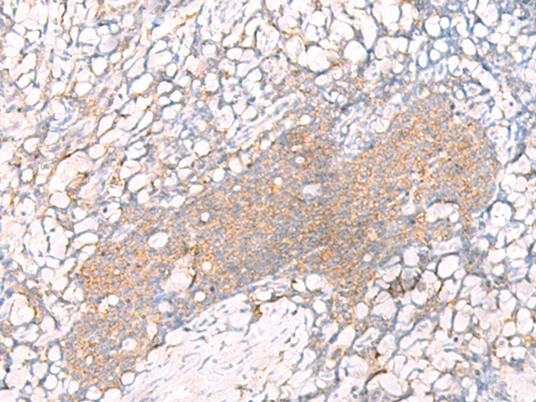 Rabbit Polyclonal Antibody to HLA-A
