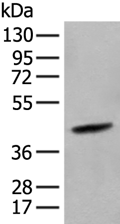 HLA-B