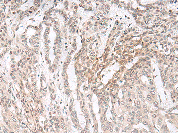 Rabbit Polyclonal Antibody to EHMT2