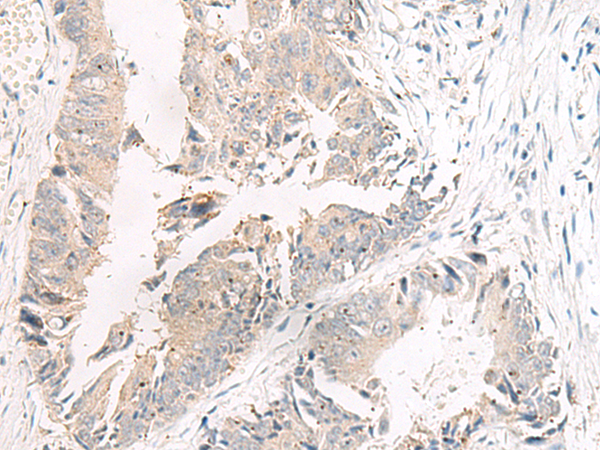 F5(Coagulation factor V light chain)