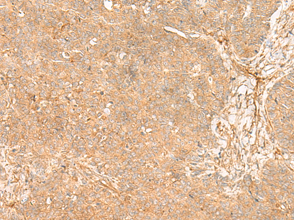 Rabbit Polyclonal Antibody to FLNC