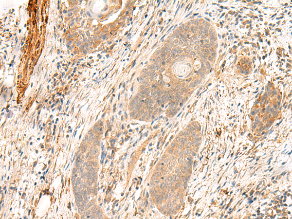 Rabbit Polyclonal Antibody to FLNC