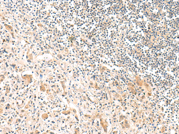 Rabbit Polyclonal Antibody to FNBP1L