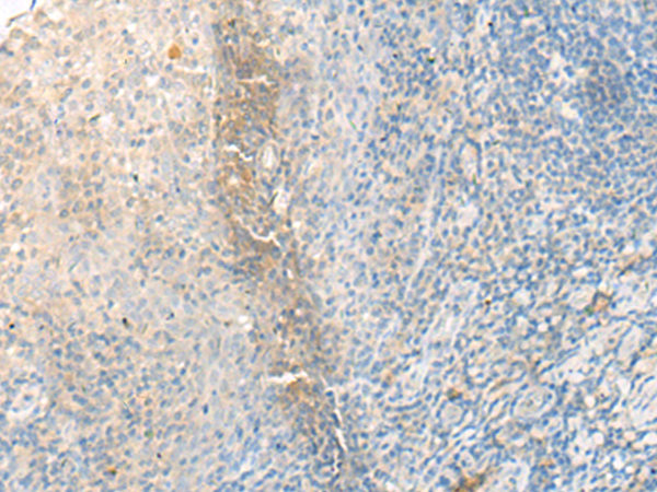 Rabbit Polyclonal Antibody to FNBP1L