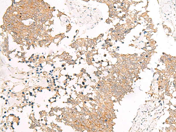 Rabbit Polyclonal Antibody to IZUMO1R