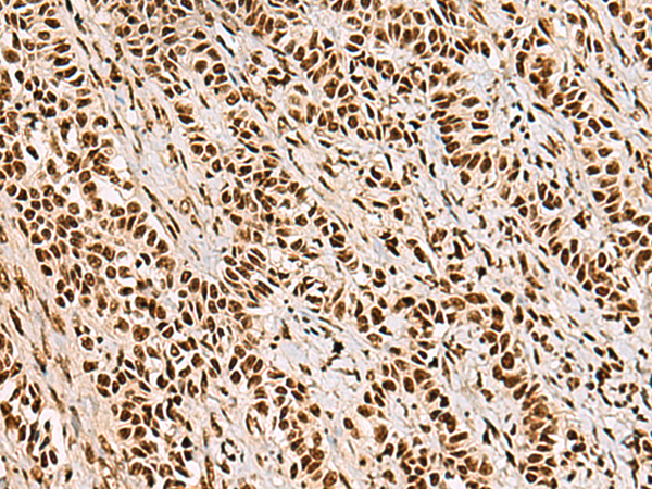 Rabbit Polyclonal Antibody to FOXI1