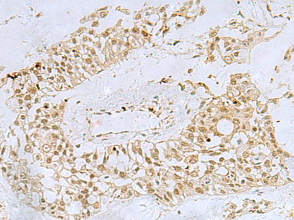 Rabbit Polyclonal Antibody to FOXQ1