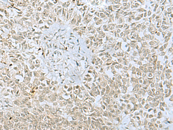 Rabbit Polyclonal Antibody to FOXQ1