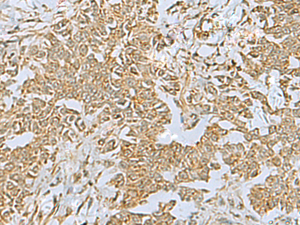 Rabbit Polyclonal Antibody to FAAP100
