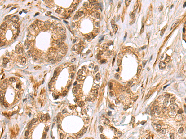Rabbit Polyclonal Antibody to SQSTM1