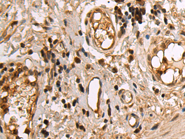 Rabbit Polyclonal Antibody to SQSTM1