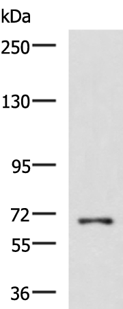 FUBP1