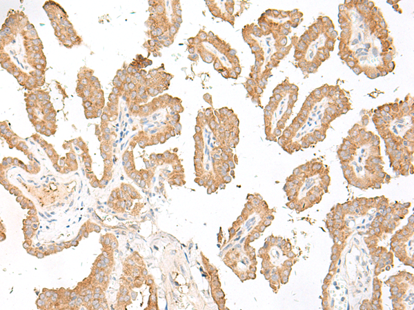Rabbit Polyclonal Antibody to FUT3