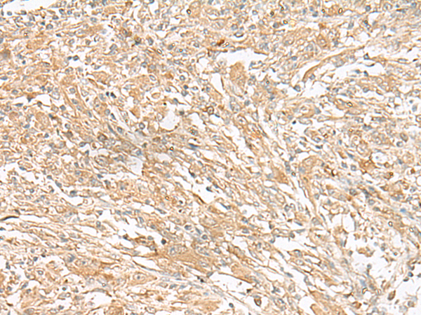 Rabbit Polyclonal Antibody to GIPC1
