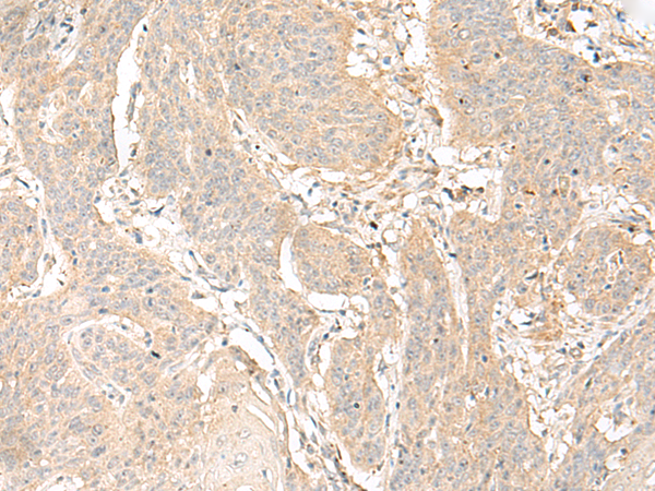 Rabbit Polyclonal Antibody to GLIS1