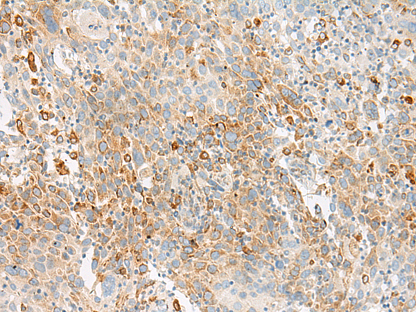 Rabbit Polyclonal Antibody to GLS2