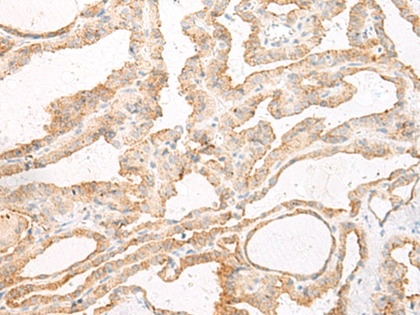 Rabbit Polyclonal Antibody to GLS2