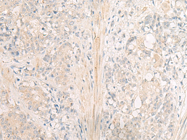 GPR26