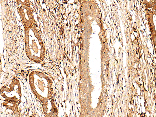 GPR27