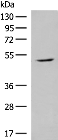 GPR142