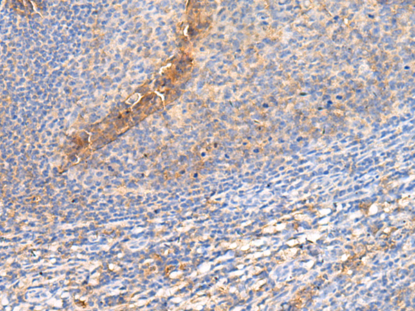 Rabbit Polyclonal Antibody to GPR142
