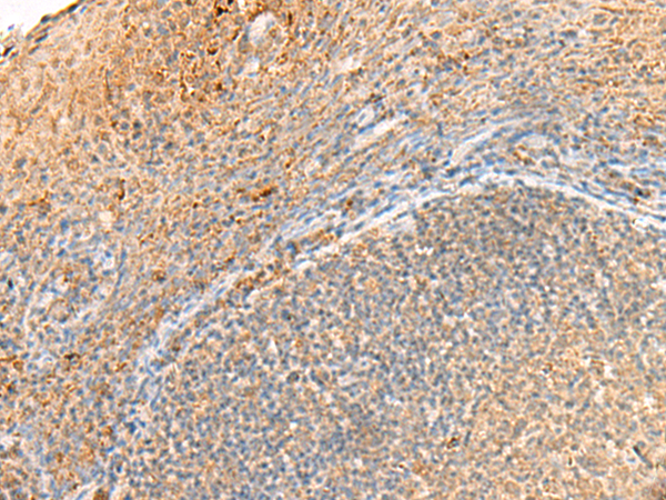 Rabbit Polyclonal Antibody to GPR161