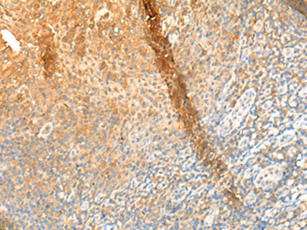 GPR162