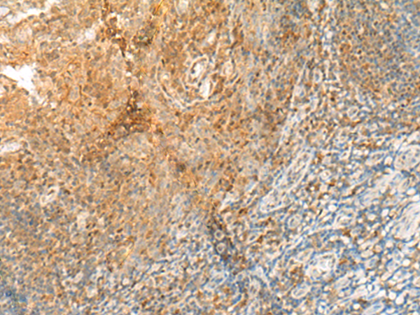 Rabbit Polyclonal Antibody to GPR89A/GPR89B