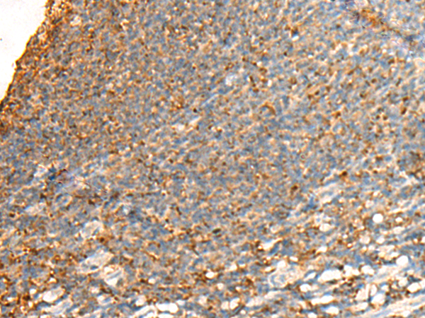 GPSM2