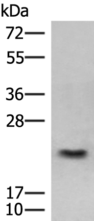 GSTM2
