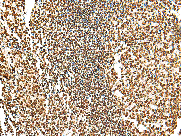 Rabbit Polyclonal Antibody to HABP4