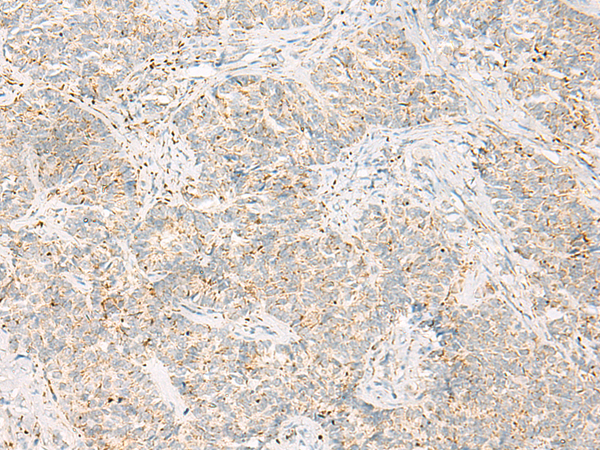 Rabbit Polyclonal Antibody to HADH