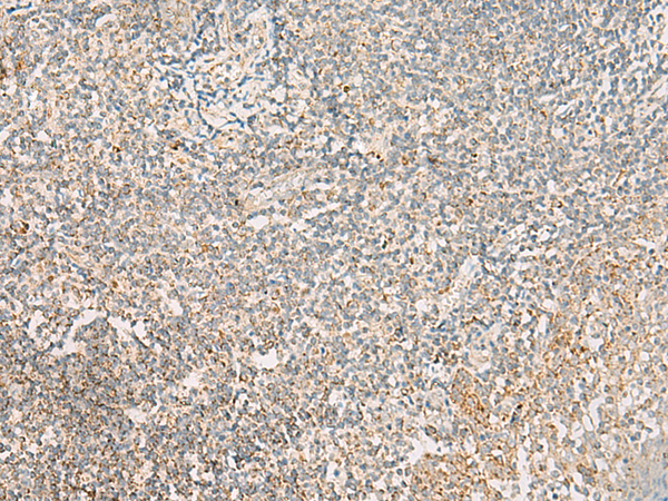 Rabbit Polyclonal Antibody to HADH
