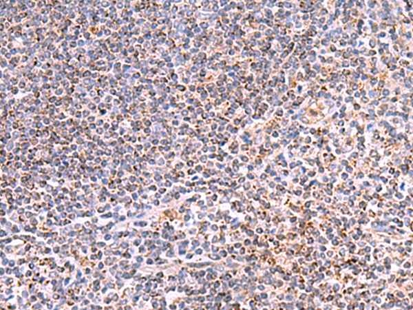 HSF2BP