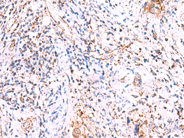 Rabbit Polyclonal Antibody to HSF2BP