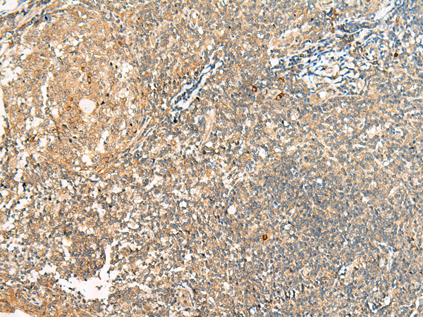 Rabbit Polyclonal Antibody to HEBP1