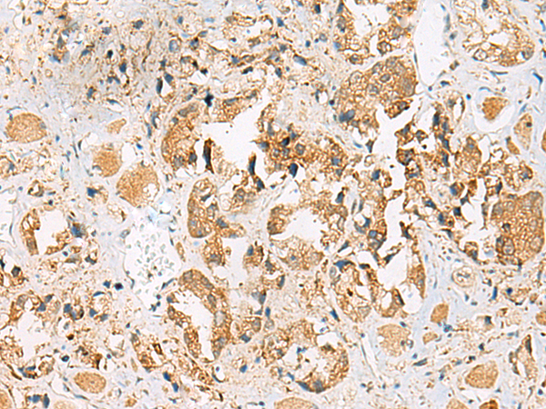 Rabbit Polyclonal Antibody to HEBP1