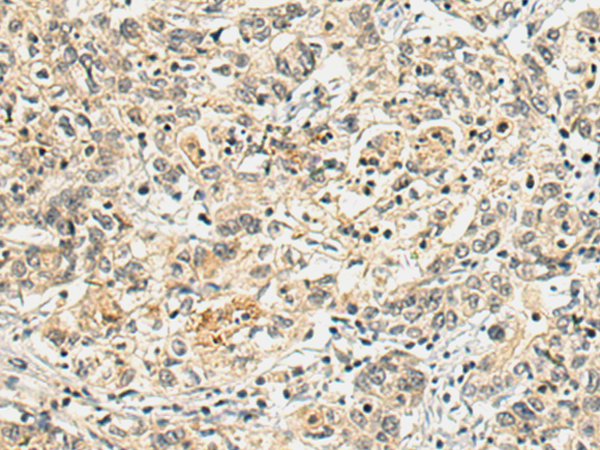 Rabbit Polyclonal Antibody to PRKCH