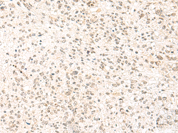 Rabbit Polyclonal Antibody to SNRPG